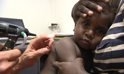 Thousands of Aboriginal kids in NT at risk of hearing loss
